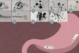 On top, photos show how the disc and bar batteries dissolve within 90 days into black dust. Below, a cartoon stomach has 2 dissolving batteries inside.