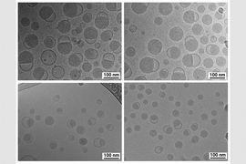 Micrograph of lipid nanoparticles