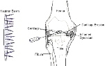 The researchers inject a boron compound into an arthritic joint and expose the joint to neutrons. The boron captures some of the neutrons to form a radioactive substance that kills the inflamed synovium, represented by the gray spots.