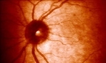 "Glowing Retina," a retina print by Elizabeth Goldring.