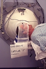 The collimator directs a beam toward the desired region.