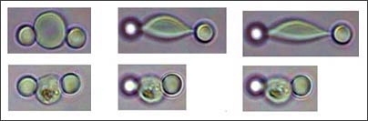 Optical tweezers stretch a healthy red blood cell (top row of images; left to right, increasing force in the picoNewton range) and a cell in a late stage of infection with the P. falciparum malaria parasite (bottom row; same force levels as above). Note the parasite visible in the bottom three images, and how the cell cannot be easily stretched by the tweezers.