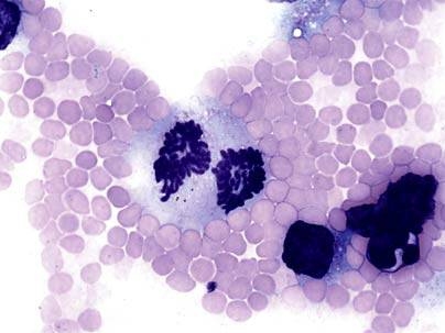 A colon cancer cell circulating in the blood stream of an LFS mouse is in the process of dividing and contains substantially more than the normal number chromosomes, a feature that is characteristic of tumor cells. <a onclick="MM_openBrWindow('mousemodel-smear-enlarged.html','','width=509, height=583')">
<span onmouseover="this.className='cursorChange';">
<strong>Open image gallery</strong>
</span...