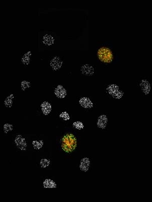 Cells that have damaged DNA in their nuclei (gray dots) normally stop dividing. However, the two cells for which MAPKAP Kinase-2 activity has been inhibited still undergo cell division (red stain), even in the presence of DNA damage (green stain).