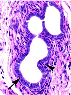 In these endometriosis lesions from the mouse model of endometriosis, both endometriotic glands (arrow) and stroma (arrowhead) are shown.