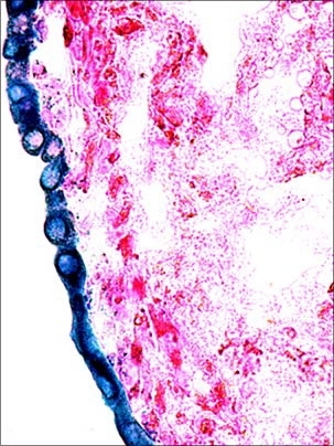 Section of a mouse ovary shows that the cells on the surface (blue) contain the mutant version of the Kras oncogene.