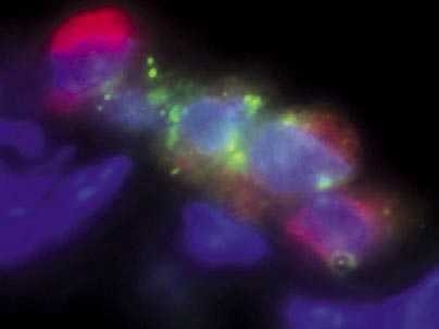 Stem cells in the lung of the mouse model for lung cancer.