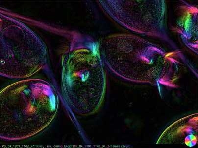 Image of the protozoa, Vorticella convallaria, with coils expanded.
