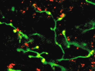 This confocal microscopy image shows activity in the rat brain, with the retinal nerve pathway showing green and the functional synapses appearing yellow.