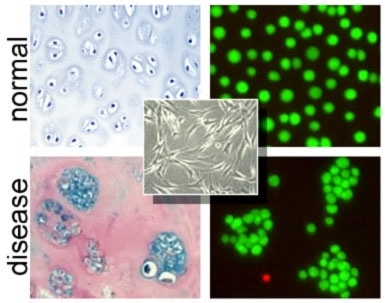 Cells are organized differently in normal and diseased cartilage (left). Now these changes can be made and studied in the lab. Here, 3-D cell clusters are precisely re-created in a tissuelike gel (right). The same cells in a conventional 2-D Petri dish look and behave much differently (inset).