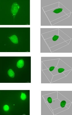 Researchers tracked the movement of human prostate tumor cells, such as the one at left, in a 3-D matrix, right.