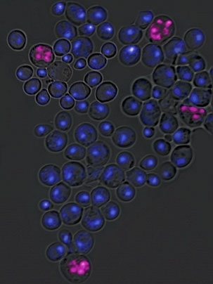 Haploid cells, which contain one copy of each chromosome, should not undergo further reduction of their chromosome number (through a type of cell division called meiosis). To prevent such a catastrophic event, haploids block the production of a protein called IME4, which triggers meiosis, by expressing antisense IME4. Failure to block sense IME4 results in the aberrant meiotic events shown above i...