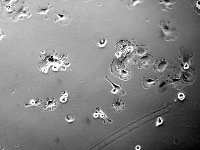 MIT researchers have discovered that treating bone marrow stem cells with a growth factor called EGF promotes their survival and growth when the EGF is tethered to a scaffold. This image shows stem cells with no EGF treatment. <a onclick="MM_openBrWindow('stem-cells-1-enlarged.html','','width=509, height=583')">
<span onmouseover="this.className='cursorChange';">Open image gallery</span>
</a>
<...