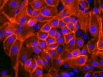 Grown in a newly invented culture medium, these normal human breast cells (whose membranes are stained red) form sheets.