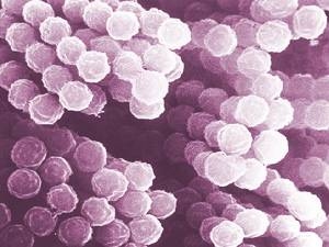 A scanning electron micrograph of one of the 
seventeen fungal species analyzed in the study.