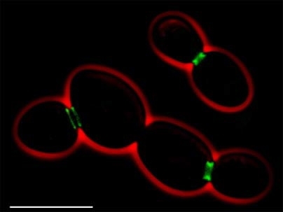 Fluorescent micrograph (scale bar: 10 micrometers) shows yeast cells (red) with septin (green), which enables the budding of daughter cells. MIT researchers have found septin also helps neurons sprout the branch-like protrusions used to communicate with other neurons.Â