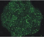 Liver cells in the micropatterned co-culture form tube-like structures (shown here in green) that resemble bile capillaries found in a human liver.