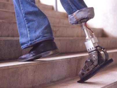 This prototype of the Power Ankle-Foot Prosthesis, developed by MIT Media Lab Professor Hugh Herr, is featured in the MoMA exhibit 'Design and the Elastic Mind.'