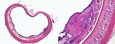 Cross-section and close-up of a rabbit trachea whose inner lining has been damaged.