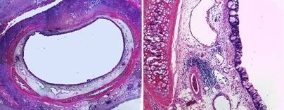 Cross-section and close-up of a rabbit trachea whose inner lining has been damaged. The injuries here were treated by adding engineered tracheal cells.