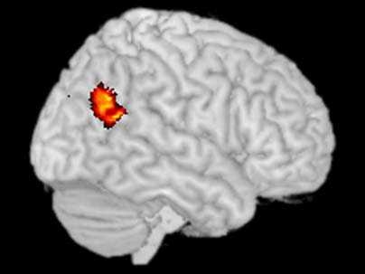 This brain scan, taken with functional magnetic resonance imaging, shows an area of the brain known as the temporoparietal junction (TPJ) lit up.  MIT neuroscientist Rebecca Saxe has shown that the TPJ is active when people think about other people's thoughts.