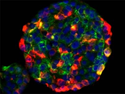 Human mammary epithelial cells that undergo an epithelial-to-mesenchymal transition (EMT) in culture may grow in suspension into structures called mammospheres--a trait they share with mammary epithelial stem cells. Here, the yellow cells present surface proteins indicating that they can develop into more than one type of mammary cell.