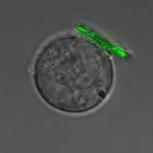 MIT researchers have developed a technique to attach tiny polymer "backpacks" to cells. This immune system cells, a B lymphocyte sports one. The scale bar is 10 micrometers.
