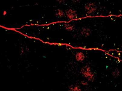 The dendrite of a new neuron in the brain (labeled in red). The small yellow spots are synapses that the new neuron is receiving.