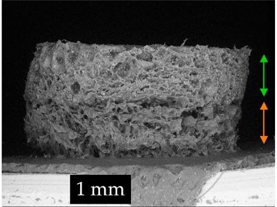 MIT and Cambridge University scientists developed this tissue scaffold that could help repair knees and other joints. The top section, indicated by the green arrow, stimulates bone growth, while the lower half, marked by the orange arrow, stimulates cartilage growth.