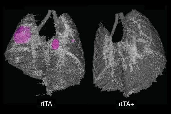 Left: Tumors are visible in the lungs of a mouse in which the NF-kappaB protein is not inhibited. Right: In the lungs of a mouse in which NF-kappaB is inhibited, tumor growth is significantly slowed. Images were taken at the Koch Institute Microscopy and Imaging Core Facility.