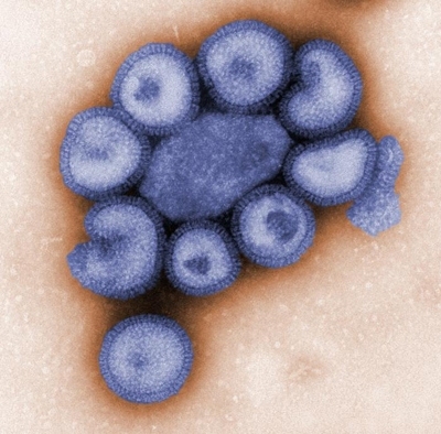 This colorized negative-stained transmission electron micrograph (TEM) depicts the ultrastructural details of a number of influenza virus particles, or “virions."
