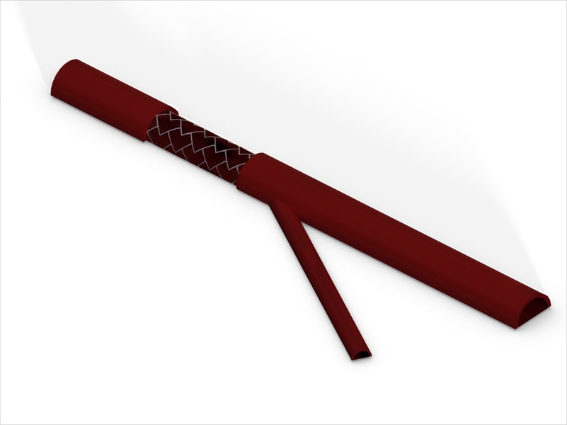 Model of an arterial bifurcation with a stent placed at the upstream section of the flow divider.