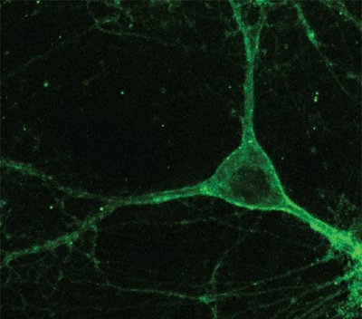 Mouse neuron expressing Arch gene