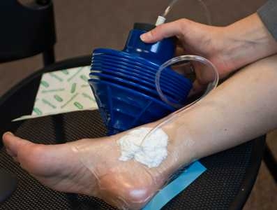 In the World: Better wound treatment for all | MIT News