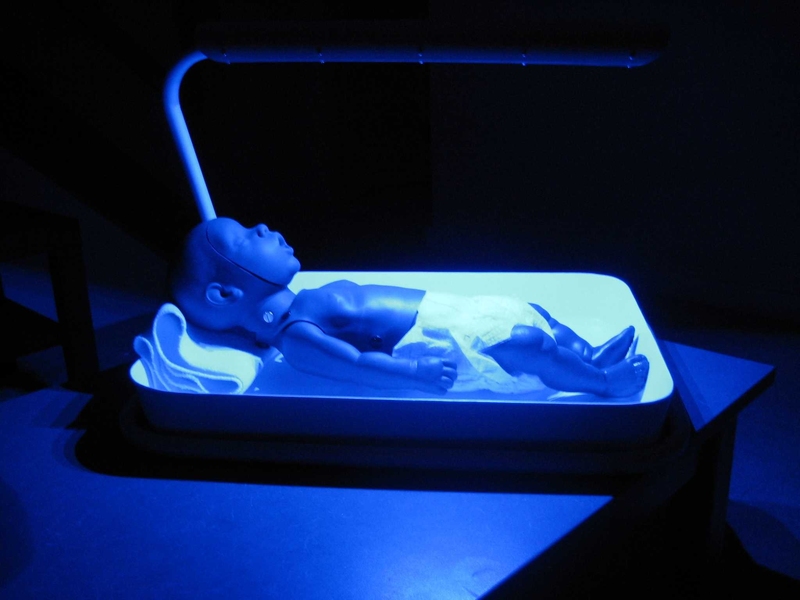 A device for newborn infants with jaundice delivers phototherapy to treat the condition