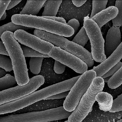 A scanning electron micrograph of E. coli,