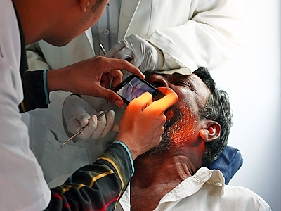 Using Sana, health-care workers take photos of precancerous lesions inside a patient’s mouth in India. Those images were then transmitted to an oncologist for diagnosis.