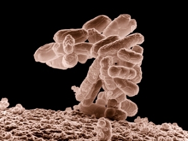 A close-up view of E. coli.