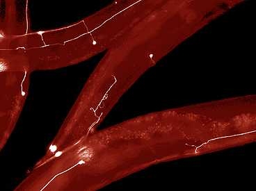 MIT engineers have developed a way to rapidly perform surgery on single nerve cells in the worm C. elegans. The white lines represent axons — long extensions of nerve cells that carry messages to other cells.