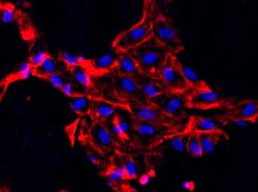 This fluorescent image shows endothelial cells embedded in a scaffold made of collagen. The cell nuclei are blue, and actin inside the cells shows up as red.
