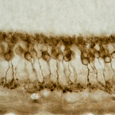 An image of rod bipolar cells in human retina.