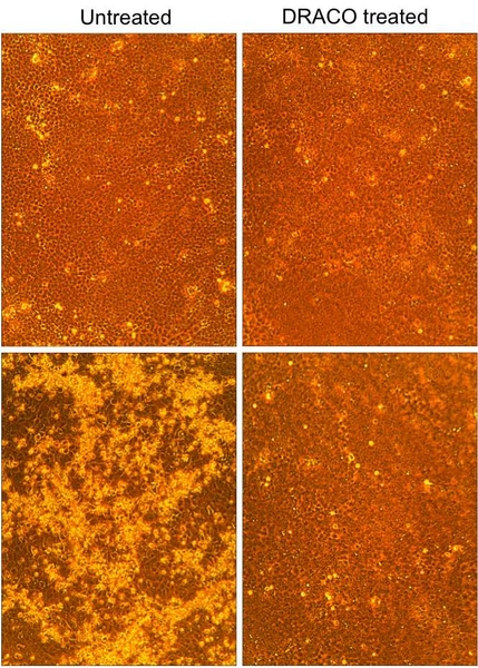 The microscope images above show that DRACO successfully treats viral infections. In this set of four photos, dengue hemorrhagic fever virus kills untreated monkey cells (lower left), whereas DRACO has no toxicity in uninfected cells (upper right) and cures an infected cell population (lower right).