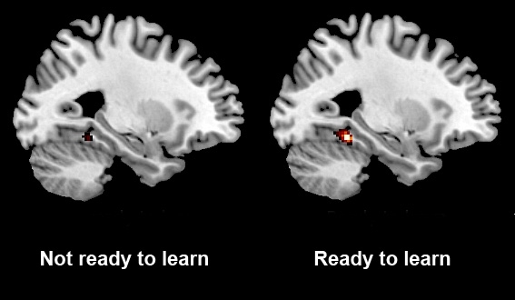 MIT neuroscientists showed that activity in a part of the brain called the parahippocampal cortex correlates with the brain’s preparedness to learn new information.