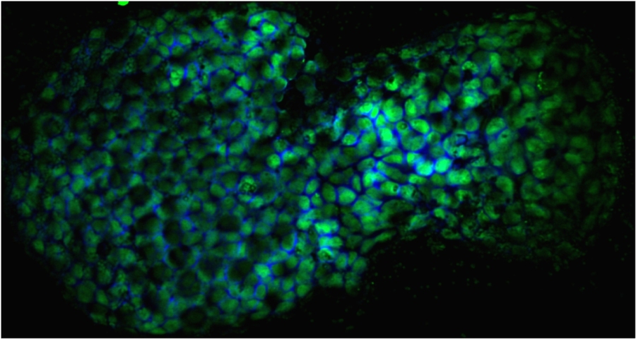 A confocal micrograph image of an early ciliate fossil. The bubbly structures are in fluorescent green.
