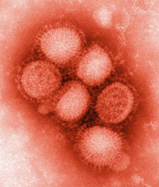 An influenza strain.