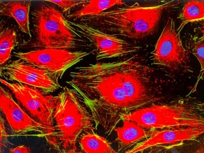 Endothelial cells