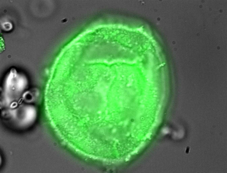 A closer view of one of the protein-producing particles.