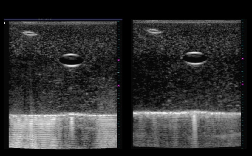Two black and white images with two bubbles toward the top