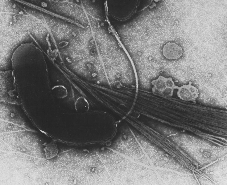 A transmission electron microscope image of <i>Vibrio choleraethat</i>.