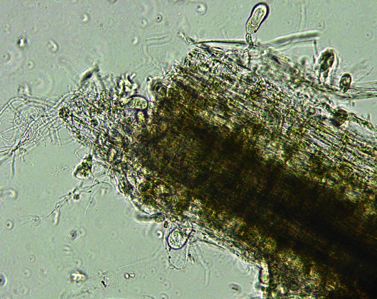In this image, anaerobic fungi that MIT researchers isolated from horse feces are seen colonizing wheat straw. The fungi appear as dark oval shapes burrowing into the straw—behavior typical of anaerobic fungi in the digestive system. Because such gut fungi tend to be associated with solids, they are not found in analyses of liquid gut samples. As a result, their presence and their contribution t...